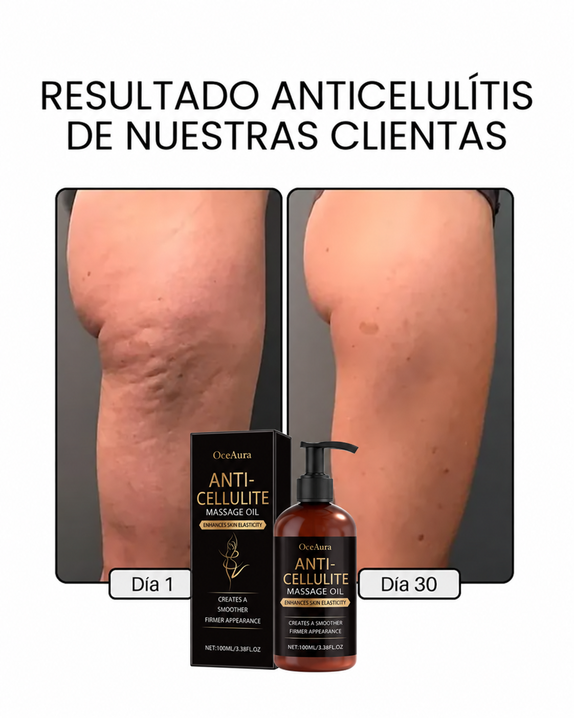 DERMODELUXE – Emulsión Corporal Anticelulitis, Antiflacidez y Efecto Drenante