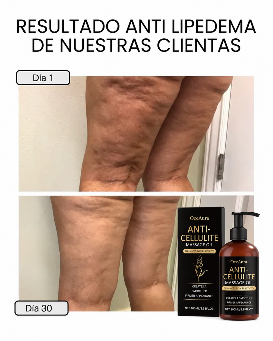 DERMODELUXE – Emulsión Corporal Anticelulitis, Antiflacidez y Efecto Drenante