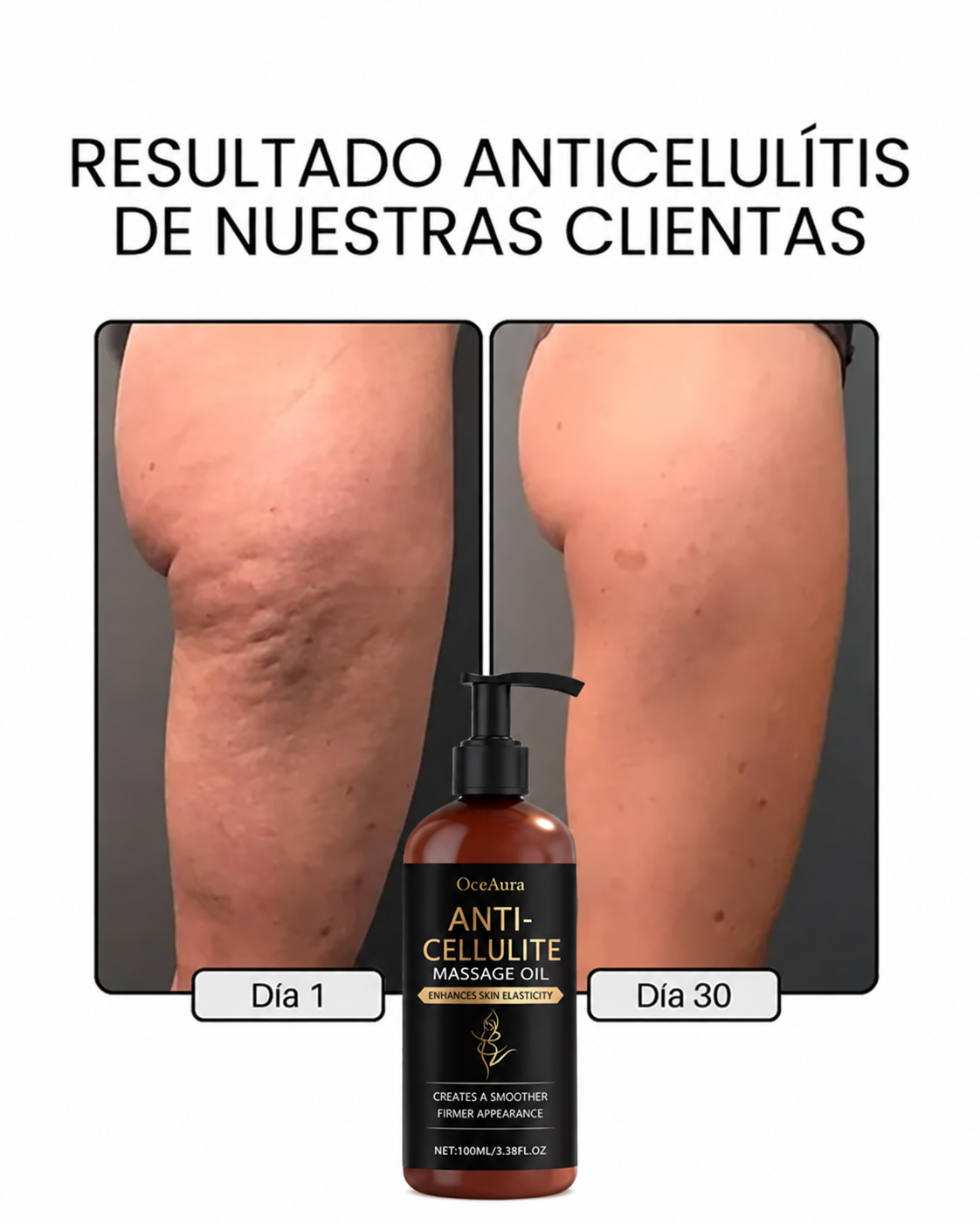 DERMODELUXE – Emulsión Corporal Anticelulitis, Antiflacidez y Efecto Drenante